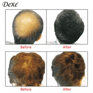 Dexe-Hair_Building_Fibers